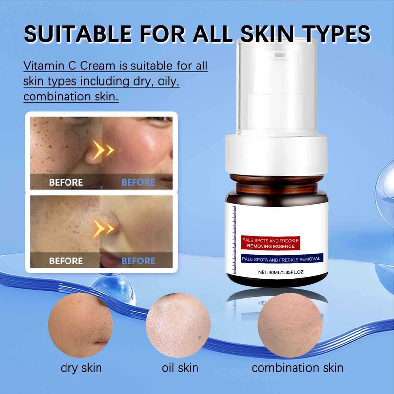 ✨✨Dark Spot Remover For Face & Body Advanced Corrector Serum 40ml