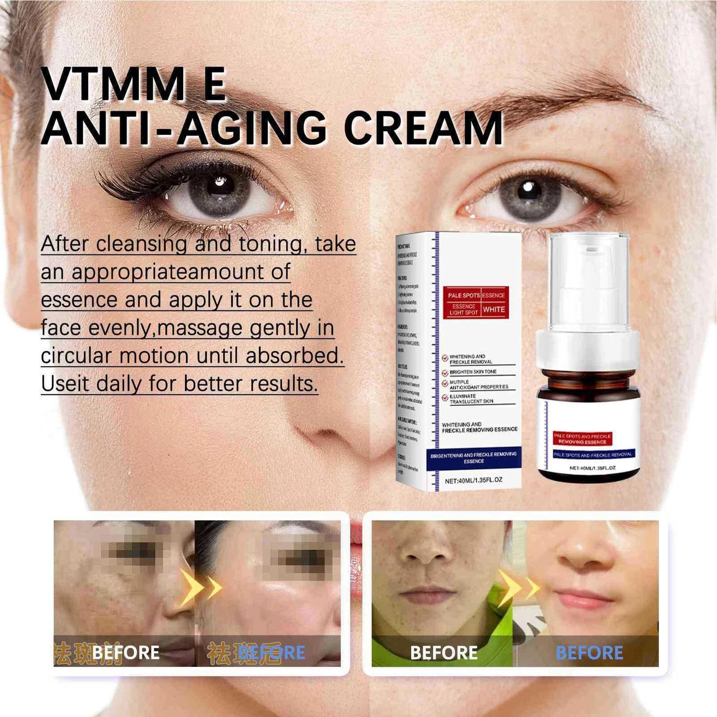 ✨✨Dark Spot Remover For Face & Body Advanced Corrector Serum 40ml