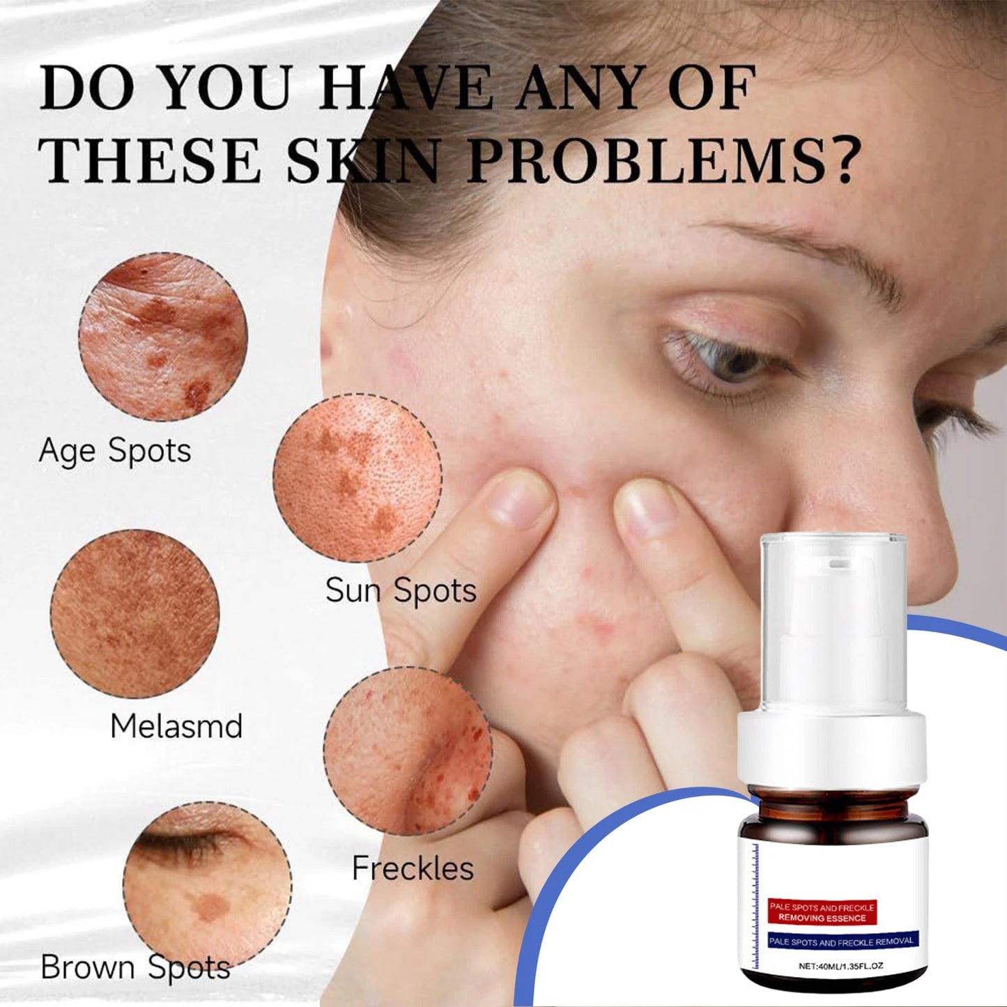 ✨✨Dark Spot Remover For Face & Body Advanced Corrector Serum 40ml